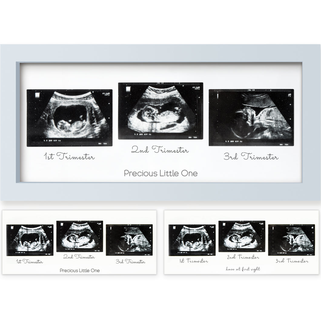 Trio Baby Sonogram Frame (Mist Blue)