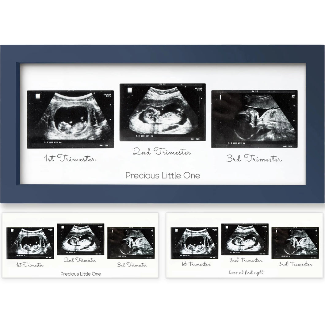 Trio Baby Sonogram Frame (Midnight Blue)