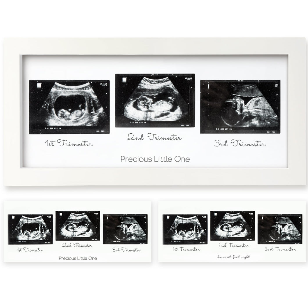 Trio Baby Sonogram Frame