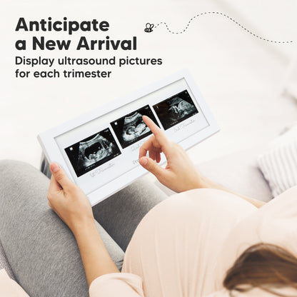 Anticipate a New Arrival, beautifully showcase ultrasound milestones throughout pregnancy. 23212287918266
